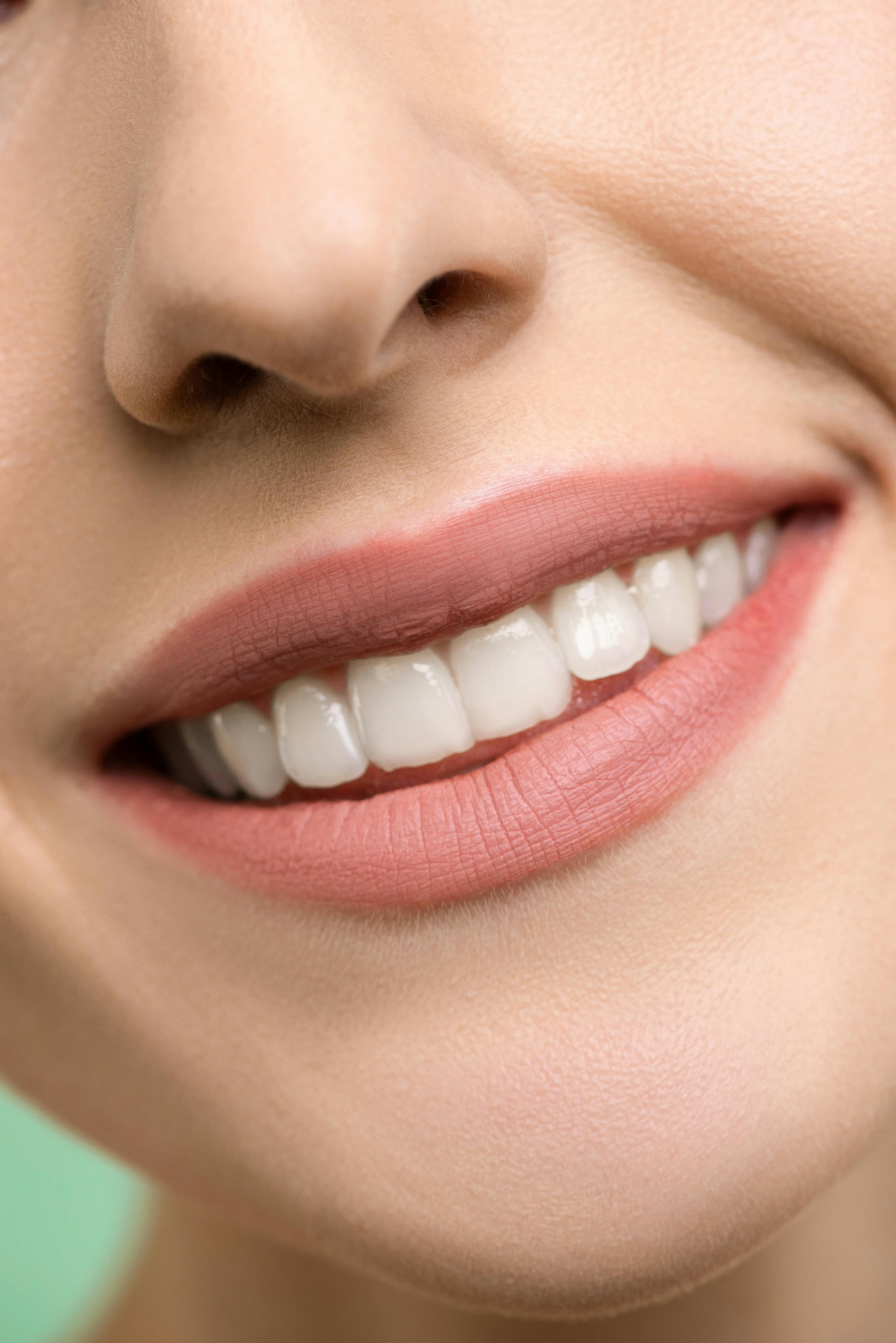 Veneers & Smile Designing